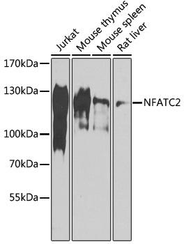 NFATC2 Rabbit Polyclonal Antibody