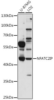 NFATC2IP Rabbit Polyclonal Antibody