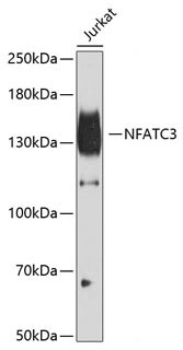 NFATC3 Rabbit Polyclonal Antibody