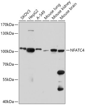 NFATC4 Rabbit Polyclonal Antibody
