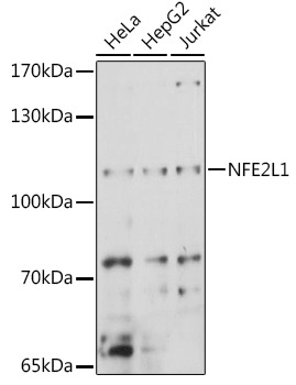 NFE2L1 Rabbit Polyclonal Antibody