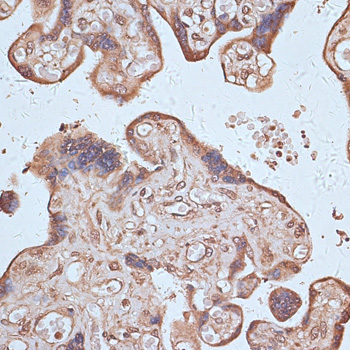 NFE2L1 Rabbit Polyclonal Antibody - Image 3