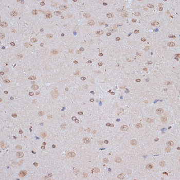 NFE2L1 Rabbit Polyclonal Antibody - Image 4