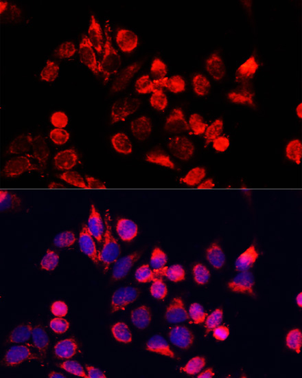 NFE2L1 Rabbit Polyclonal Antibody - Image 5