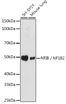NFIB / NF1B2 Rabbit Monoclonal Antibody
