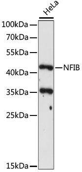 NFIB Rabbit Polyclonal Antibody