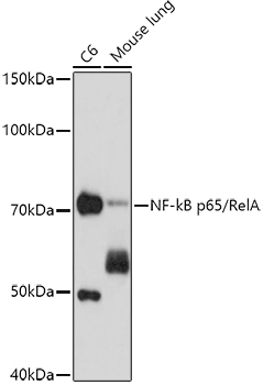 NF-kB p65/RelA Mouse Monoclonal Antibody