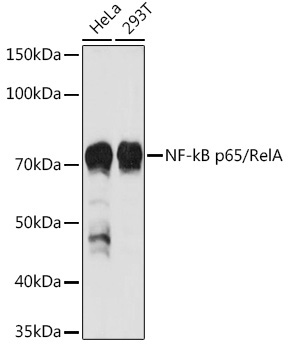 NF-kB p65/RelA Rabbit Polyclonal Antibody