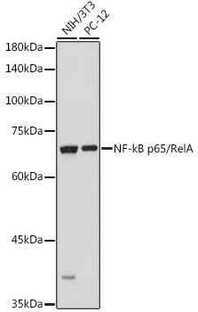 NF-kB p65/RelA Rabbit Polyclonal Antibody