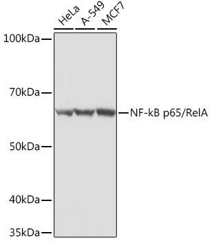 NF-kB p65/RelA Rabbit Polyclonal Antibody