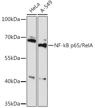 NF-kB p65/RelA Rabbit Polyclonal Antibody