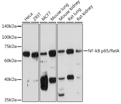 NF-kB p65/RelA Rabbit Polyclonal Antibody