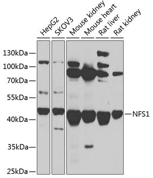 NFS1 Rabbit Polyclonal Antibody