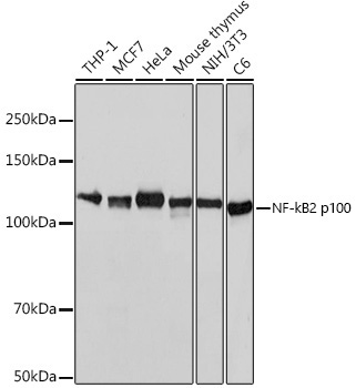 NF-?B2 Rabbit Monoclonal Antibody
