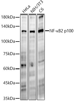 NF-?B2 Rabbit Monoclonal Antibody