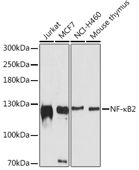 NF-?B2 Rabbit Polyclonal Antibody
