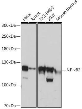 NF-?B2 Rabbit Polyclonal Antibody
