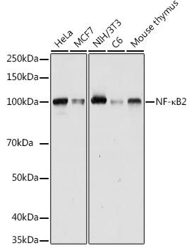 NF-?B2 Rabbit Polyclonal Antibody