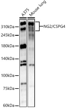 NG2/CSPG4 Rabbit Polyclonal Antibody