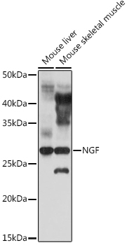 NGF Rabbit Polyclonal Antibody