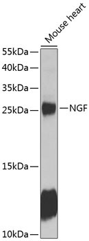 NGF Rabbit Polyclonal Antibody