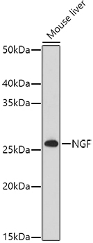 NGF Rabbit Polyclonal Antibody