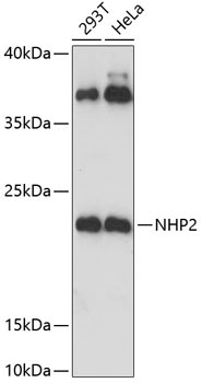 NHP2 Rabbit Polyclonal Antibody