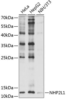 NHP2L1 Rabbit Polyclonal Antibody