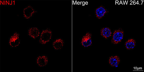 NINJ1 Rabbit Monoclonal Antibody