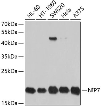 NIP7 Rabbit Polyclonal Antibody