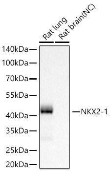 NKX2-1 Rabbit Monoclonal Antibody