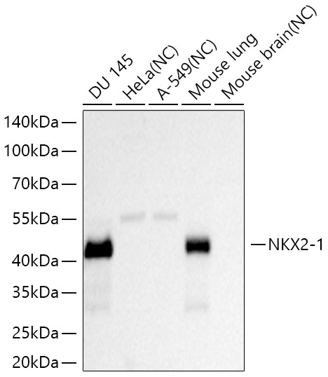 NKX2-1 Rabbit Monoclonal Antibody - Image 2