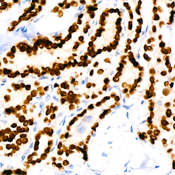 NKX2-1 Rabbit Monoclonal Antibody - Image 2