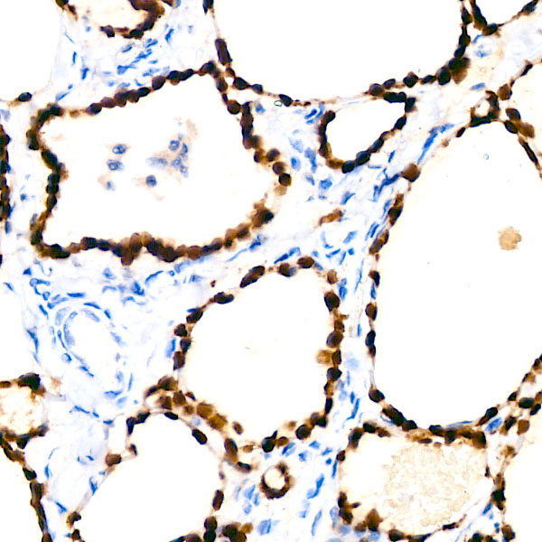 NKX2-1 Rabbit Monoclonal Antibody - Image 3