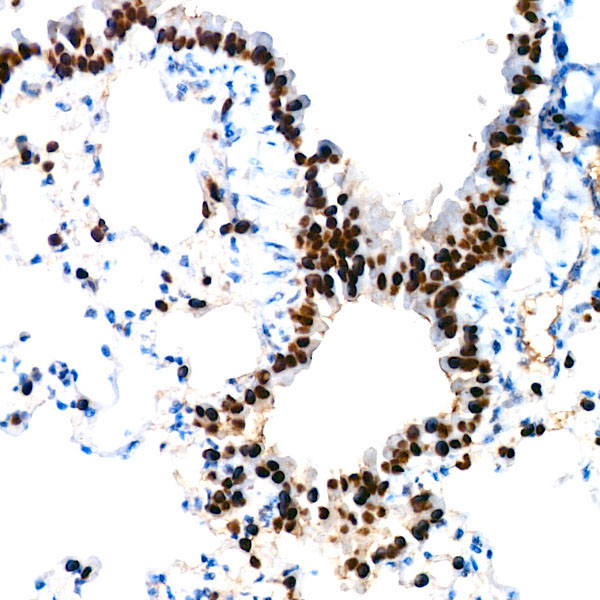 NKX2-1 Rabbit Monoclonal Antibody - Image 4