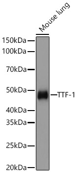 NKX2-1 Rabbit Monoclonal Antibody
