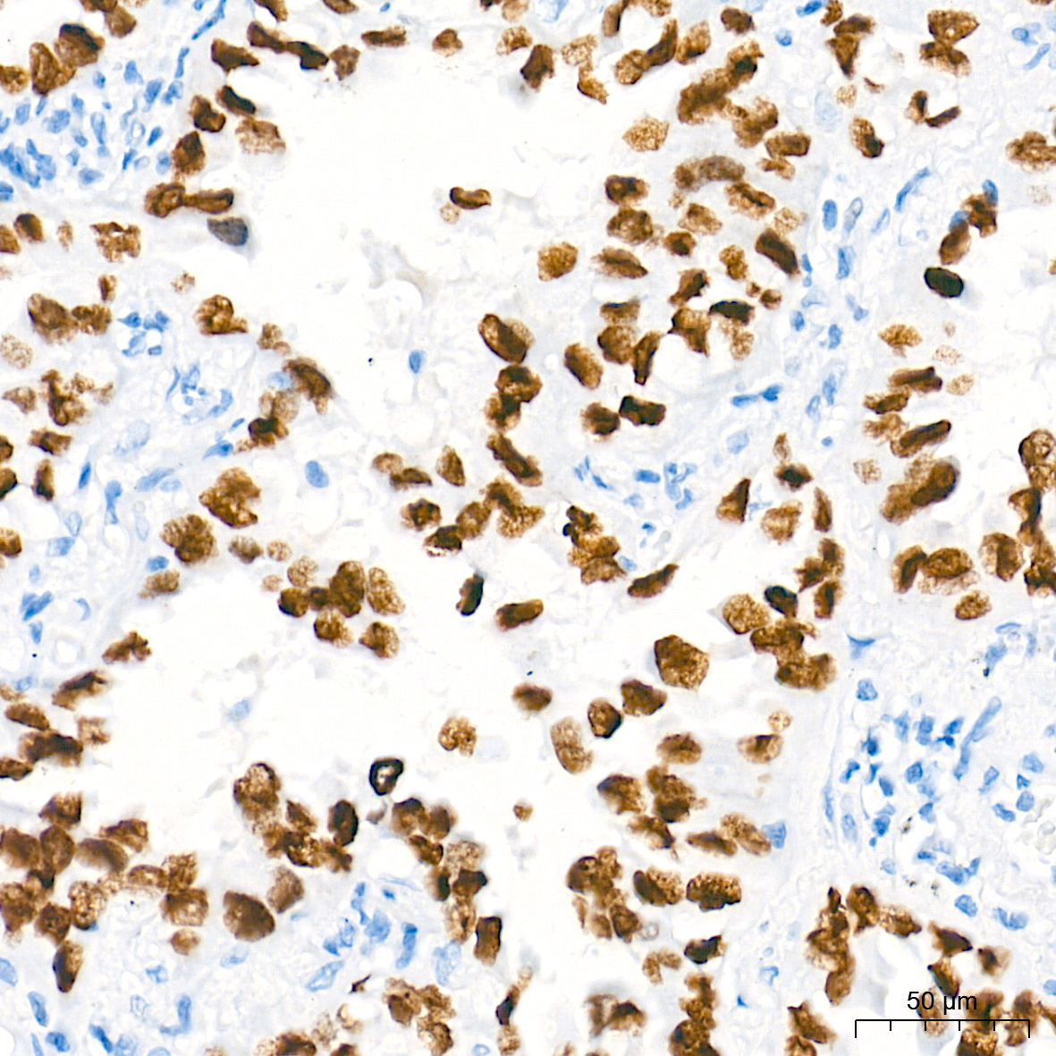 NKX2-1 Rabbit Monoclonal Antibody - Image 2