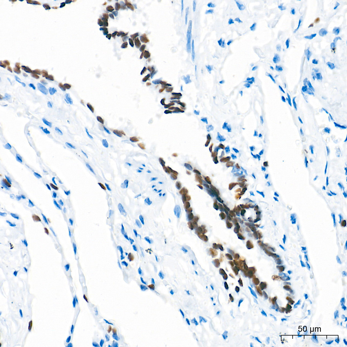 NKX2-1 Rabbit Monoclonal Antibody - Image 3