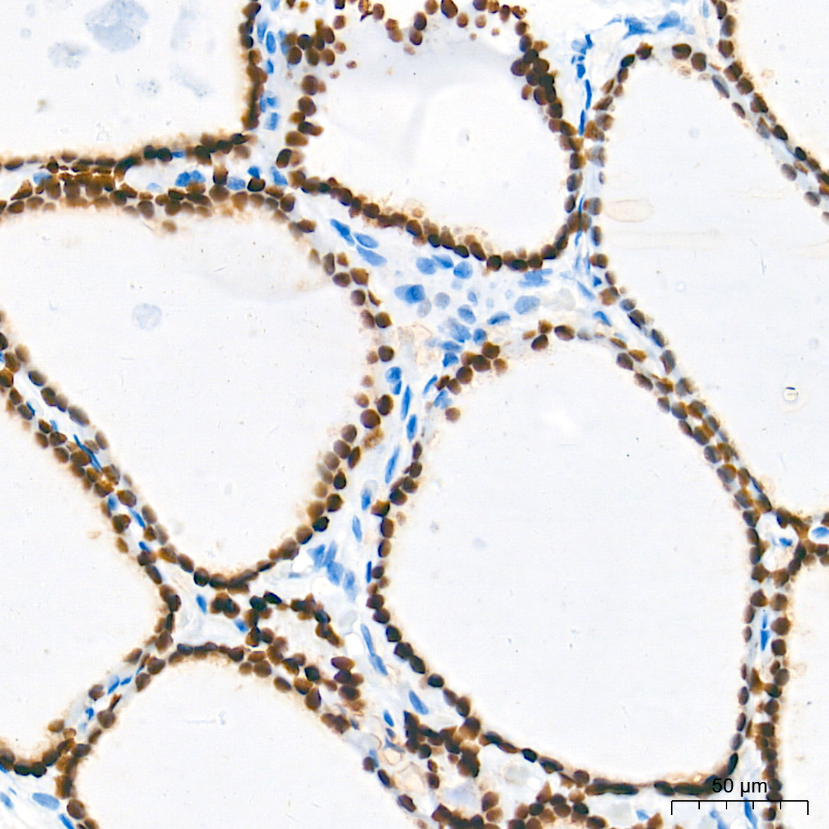 NKX2-1 Rabbit Monoclonal Antibody - Image 4