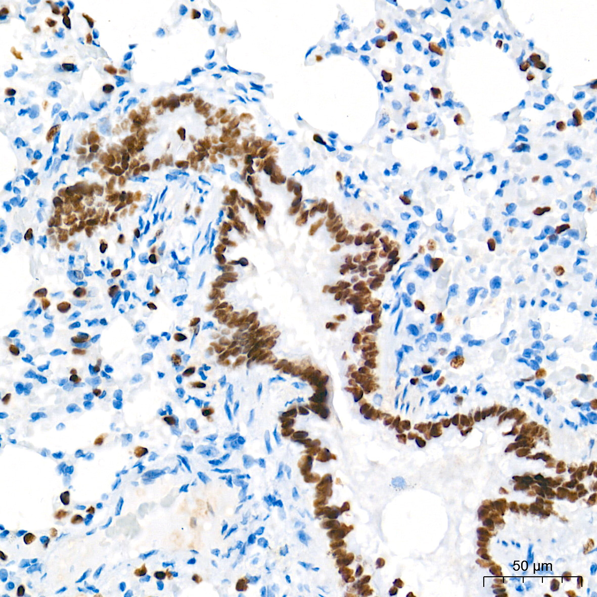 NKX2-1 Rabbit Monoclonal Antibody - Image 5