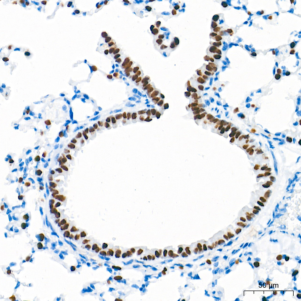 NKX2-1 Rabbit Monoclonal Antibody - Image 6