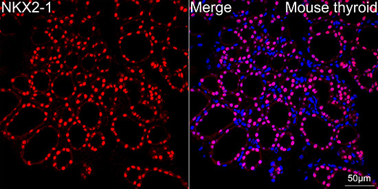 NKX2-1 Rabbit Monoclonal Antibody - Image 7