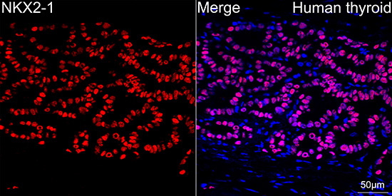 NKX2-1 Rabbit Monoclonal Antibody - Image 8