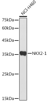 NKX2-1 Rabbit Polyclonal Antibody