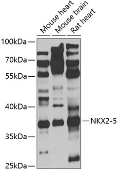NKX2-5 Rabbit Polyclonal Antibody