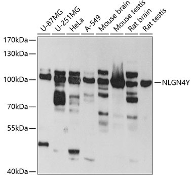 NLGN4Y Rabbit Polyclonal Antibody