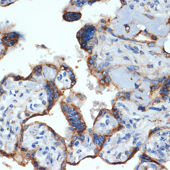 NLK Rabbit Monoclonal Antibody - Image 2