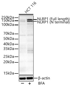 NLRP1 Rabbit Polyclonal Antibody