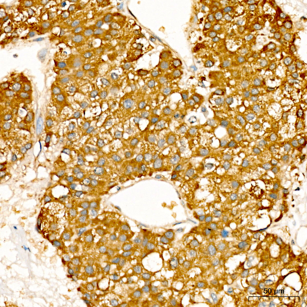 nm23 Rabbit Polyclonal Antibody