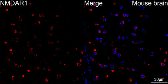 NMDAR1 Rabbit Monoclonal Antibody - Image 2